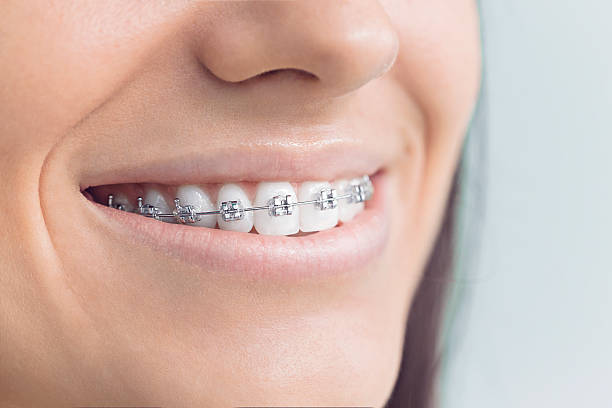 Best Dental Fillings (Composite and Amalgam)  in Quinlan, TX
